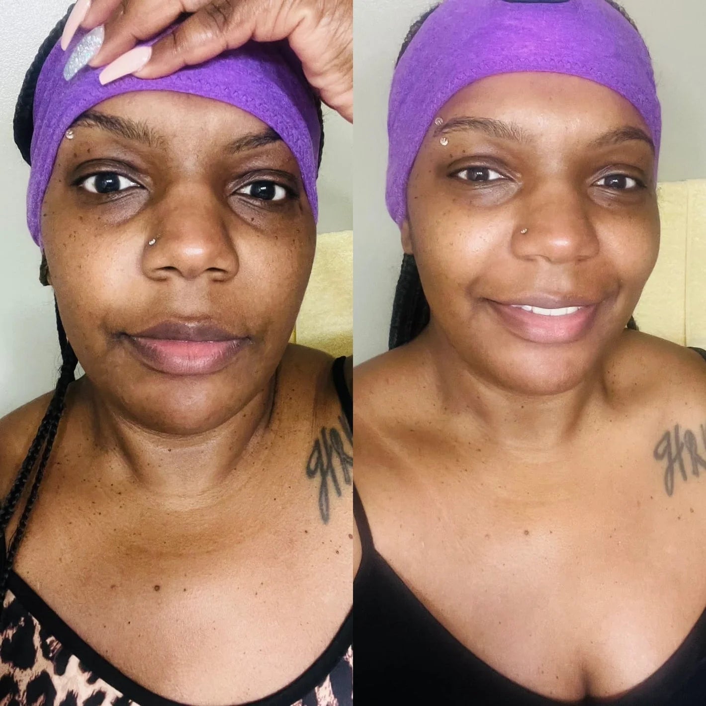 JIYU Toner Pads - Korean Toner Pads Review - Before & After