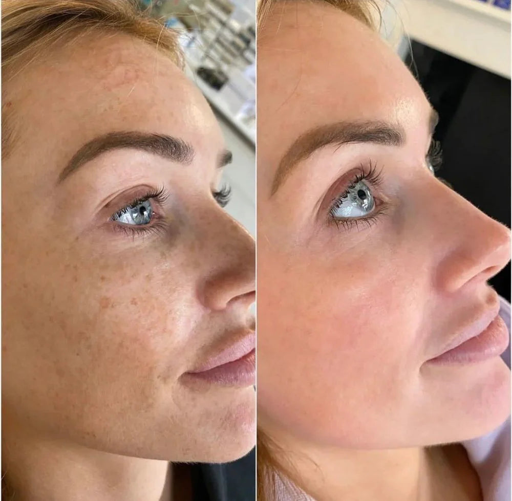 JIYU Toner Pads - Korean Toner Pads Review - Before & After