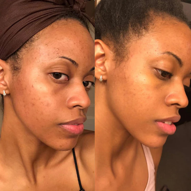 JIYU Toner Pads - Korean Toner Pads Review - Before & After