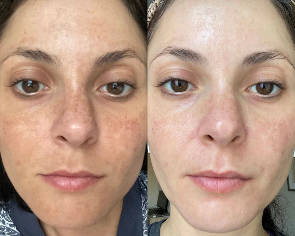 JIYU Toner Pads - Korean Toner Pads Review - Before & After